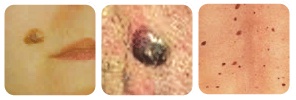 moles