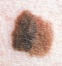 Mole Diameter